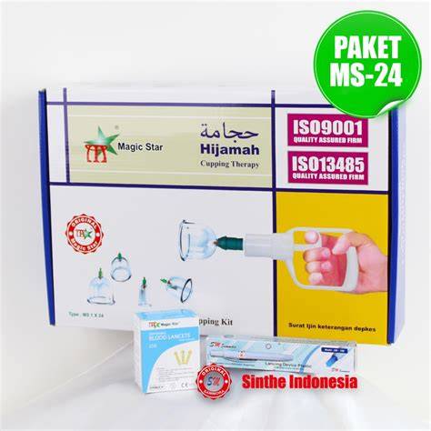 ALLY ANN REDTUBE untuk pelanggan chip ekonomis — panduan ringkas magic pen build image 1