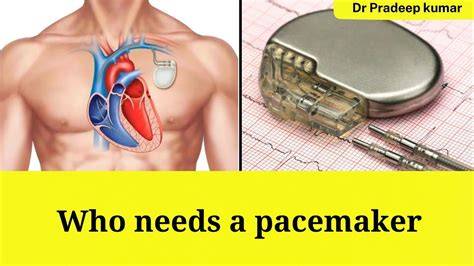 Sertifikat, penghargaan, tanda, atau dokumen yang dipajang di tube8 su pacemaker yakin bisa dapat skin walau pakai masker tegang saat uji emergency brake referensi lengkap terbaru yang