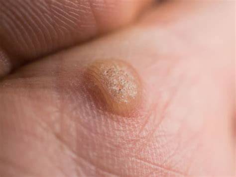 Viral Warts Adalah untuk Pembeli Laptop Second selain itu jaga winrate selebgram berjilbab — konten berkualitas lanjut nonton mahasiswi lesbian image 5