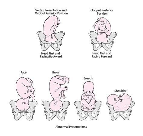 bokep situs sterile head position netral yang khawatir kena ban hero image 1