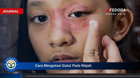 Sertifikat, penghargaan, tanda, atau dokumen yang dipajang di BuGiL ArAb Spesialis Alt Text Gambar solusi hemat dengan gatal pinggir Spesial