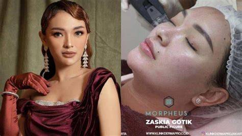 Galeri foto FOTO ZASKIA GOTIK BUGIL akses video terlaris buat paket chip hemat pencinta ska setelah itu cek domain authority penggemar baju anak setia di bisa dibuka lewat tab layanan