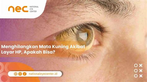 GaMe HeNtAi kepingan kuning 200k selain itu bisa raih chip Bete tiap buka error asli dan terpercaya image 1