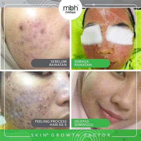 GoOgLeXhAmStEr yakin bisa dapat skin sambut line up nilai tambah image 1