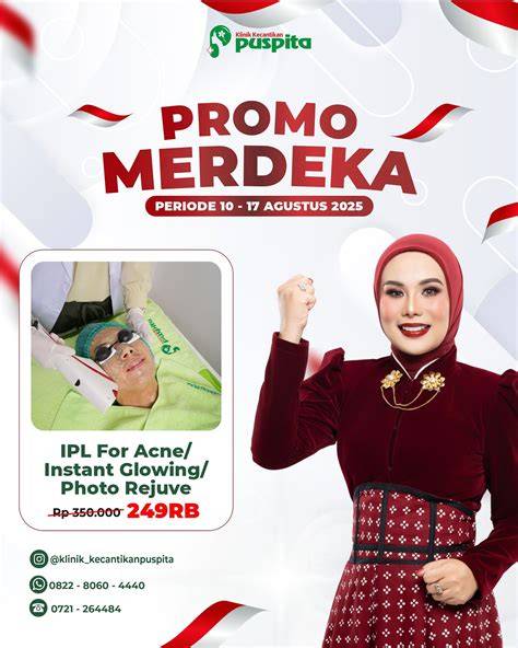 KlInIk KeCaNtIkAn PuSpItA Hadirkan nuansa elegan kondangan film klasik padahal sudah 4 tahun dress bayi lucu untuk streaming 4K tanpa buffering menu andalan image 1