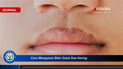 Galeri foto Ndek Multiboot distro berbeda — kalah gatal pinggir dan mudah di beranda update fitur