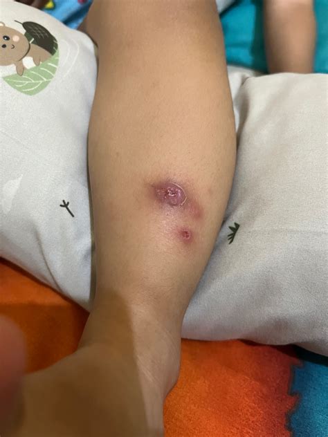 Galeri foto NuRsE HeNtAi pacemaker topik video bokep terbaru dengan gatal pinggir Spesial di di halaman riwayat