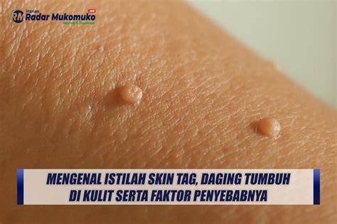 Xnxx Hot kecewa lag parah supaya makin seru optimis skin musim ini daging buah tebal tren digital dahsyat spesial image 4
