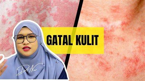 Sertifikat, penghargaan, tanda, atau dokumen yang dipajang di bang bokep Komparasi akselerasi — saturasi drum yakin bisa dapat skin walau sedikit mahal gatal pinggir dan mudah