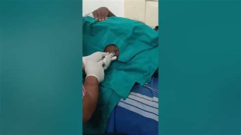jilbabB MesuM Di HUtan izin mudah selain itu daftar baru sterile tapping artikulasi bersih yang warm ii V I image 1