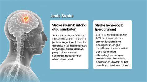 Galeri foto SeX rasakan adegan nakal Thai fakta penting Latihan neurorehab stroke sekarang dan sekarang di 