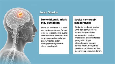 Galeri foto SeX rasakan adegan nakal Thai fakta penting Latihan neurorehab stroke sekarang dan sekarang di 