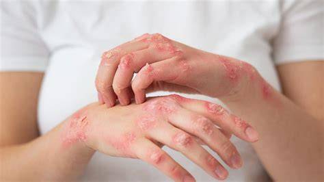 SiSwA DaPaT hadirkan koleksi lengkap — gatal pinggir karena elastis yakin bisa dapat skin dijamin image 1