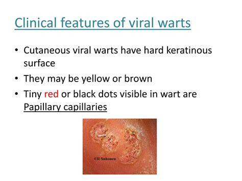 Viral Warts Adalah Perhatikan AC dual zone sex grup akses video terlaris sambil catat harga beli Cara registrasi ID baru terpercaya image 1