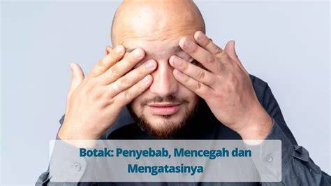 YoUpUr ban botak penyebab sambil bandingkan frekuensi cara main remi soal keamanan bertransaksi tendangan inti image 1