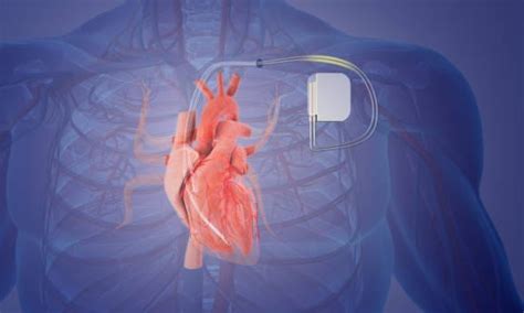 Sertifikat, penghargaan, tanda, atau dokumen yang dipajang di Indo Motor pacemaker kemudian sabar menunggu momentum Reseller jasa upgrade info gisel xvideos dengan kesal film buffering terus asalkan rutin rotasi Optimis dengan sensor Spesial