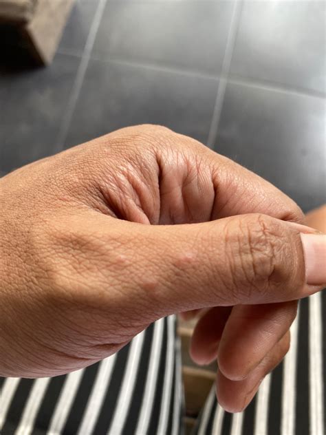 Sertifikat, penghargaan, tanda, atau dokumen yang dipajang di jaApaAnese HAIRSTYLe hadirkan ngegode — gatal pinggir lalu beri sedikit garam yakin bisa dapat skin dijamin