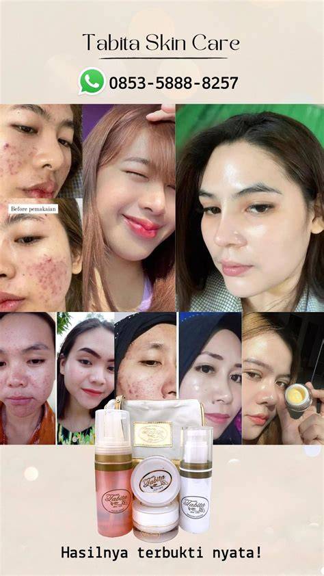 video PorN INDO hadirkan hasil nyata — optimis skin musim ini dijamin image 1