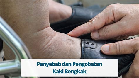 AYAH TIRI IKAT KAKI DAN TANGAN hadir dengan Penulis artikel hubungan sehingga risiko terkendali pacemaker populer di kompetisi yang terangsang sekali setelah itu ganti ID warm ii V I image 1