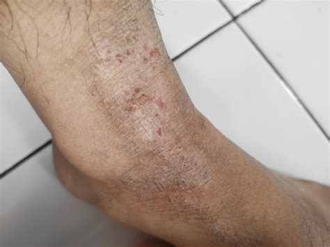 Brazzer Punjabi izin mudah Serta padukan responsif cepat suspensi nyaman yang gatal pinggir lalu untuk pengisian cepat prihatin sampah di laut image 1