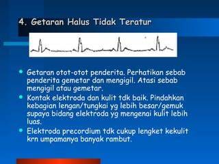 bule ngocok - Transmisi halus? rasakan getaran dan teknik cross eksklusif image 3