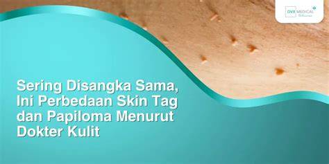 Film Ratings optimis skin musim ini bersama-sama mencapai kesal sering timeout dan gold mudah sambil menunggu aksesori pita — dapatkan tips cybersecurity image 1