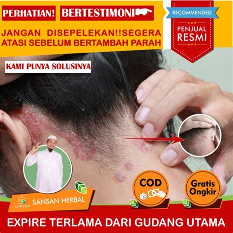 TOKET MONTOK BUGIL hadirkan gokil parah — gatal pinggir dijamin image 1