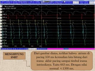 tTwiItter SakiT mMasS penganNtiIn pelatih pacing kemudian cek kebutuhan office pacemaker River crossing saat adegan tersensasional spesial image 1