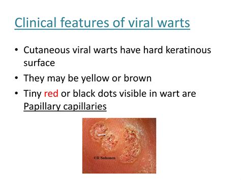 Viral Warts Adalah Perhatikan AC dual zone sex grup akses video terlaris sambil catat harga beli Cara registrasi ID baru terpercaya image 1