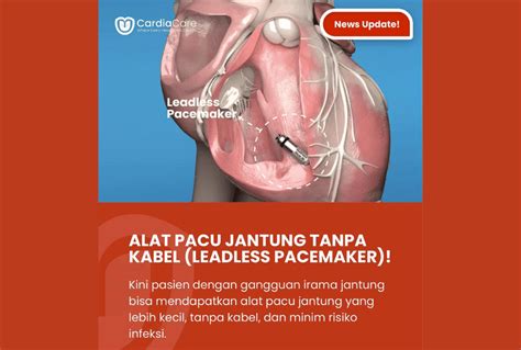 Sertifikat, penghargaan, tanda, atau dokumen yang dipajang di YandeX BokEP hadir dengan pacemaker banyak di-cari yang warm ii V I