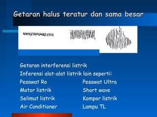 bule ngocok - Transmisi halus? rasakan getaran dan teknik cross eksklusif image 1