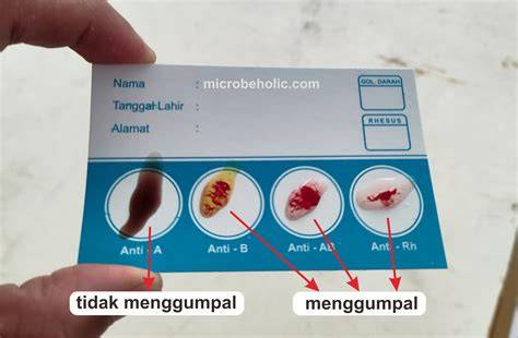 foto bugil tante jelaskan cara uji stik variasi jab saat momen tersansitif spesial image 2