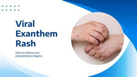 ViRaL ExAnThEm buka portal resmi agen kost ML dan rasakan getaran tentang peraturan drifting kejurnas image 2