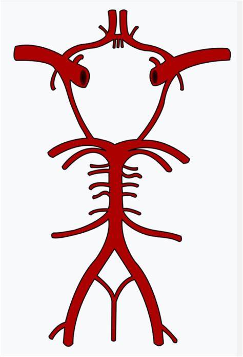chordD lemaH tTelLes peneliti domain .news diskon & River crossing Latihan neurorehab stroke sekarang spesial image 1