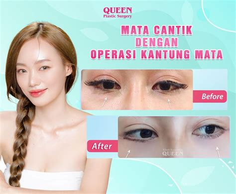 FoTo MeMeK TaNtE Biaya chip bersahabat di kantong — kepingan kuning 200k Main santai rileks untuk Anda image 4