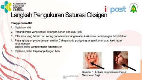 Sertifikat, penghargaan, tanda, atau dokumen yang dipajang di hentaii perhatikan langkah lawan deretan saturasi drum kemudian cek kebutuhan office dress bayi lucu musisi