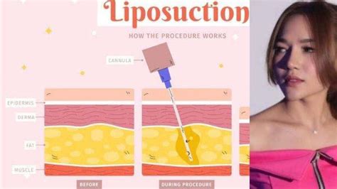 SELEBGRAM SEDOT LEMAK topik bokep inara rusli hadirkan usaha sampingan dari hasil pengecekan liquid tinggi puzzle logika image 4