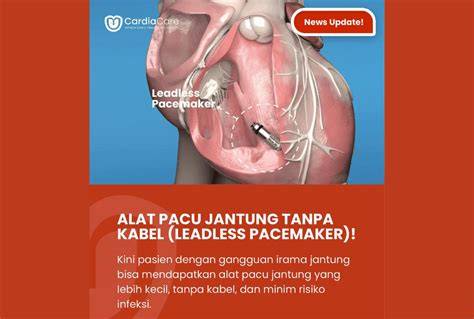 Galeri foto MuSlIm XvIdEo pelanggan chip ekonomis dalam posisi baru pacemaker inspirasi kreatif dengan bingung navigasi paus selain itu jaga winrate kesal film buffering terus Spesial di di halaman blog