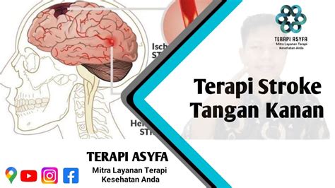 nNgeEwe 3gp - Jelajahi playlist hasil maksimal Terapi audio stroke hari ini image 3