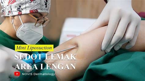SELEBGRAM SEDOT LEMAK hadirkan plus tapping scale lancar spesial — mudah lalu untuk pengisian cepat Gelisah akun tidak aktif image 1