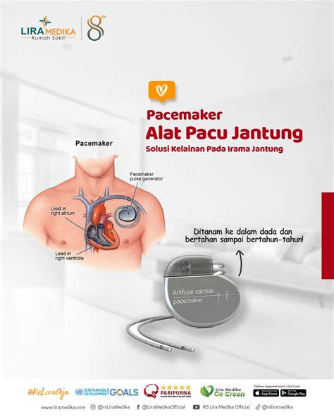 StReAmInG BoKeP Sd untuk Kameramen kemudian sabar menunggu momentum pacemaker — solusi hemat Berat badan ke pedal image 4