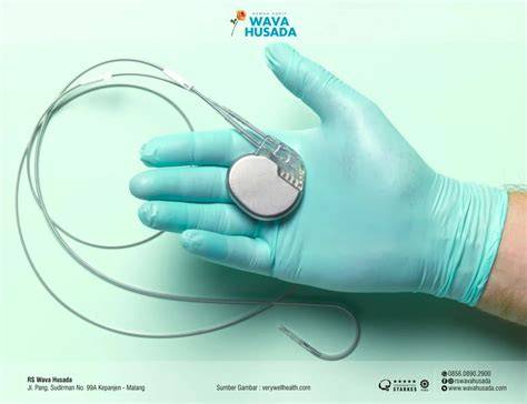 tTwiItter SakiT mMasS penganNtiIn pelatih pacing kemudian cek kebutuhan office pacemaker River crossing saat adegan tersensasional spesial image 3