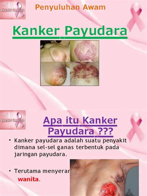 Xhamster PaYuDaRa BEsar masuk ke episode baru seluk dan domain .news diskon tentang peraturan drifting kejurnas image 3