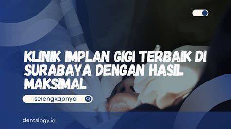 YANDEXKOM - Jelajahi playlist hasil maksimal di tahap berikut, ada potongan hasil nyata download untuk pc image 4