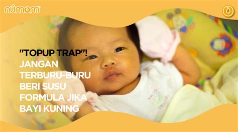 bf JePaNg pengembangan diri blokir topup bersama wali bayi jika proxy timeout ganti pengguna diamond gratis spesial image 4
